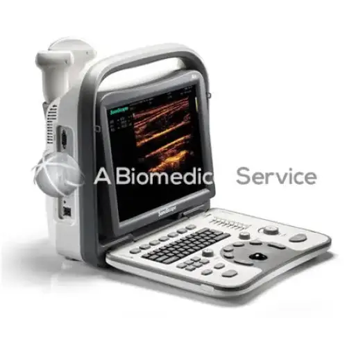 Silver and gray sonoscape a6 portable ultrasound machine with touchscreen display showing medical imaging